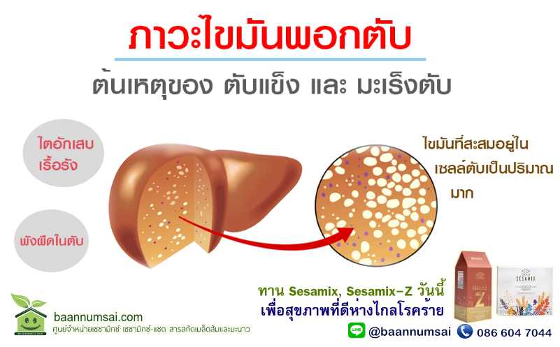 ไขมันพอกตับ อันตรายเสี่ยงโรคร้าย
